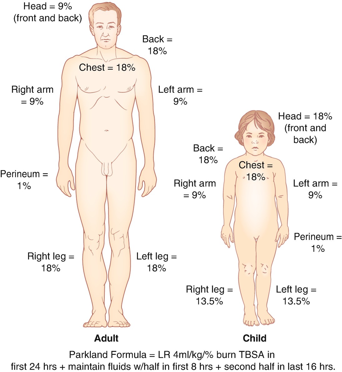 Pediatric Burns Springerlink