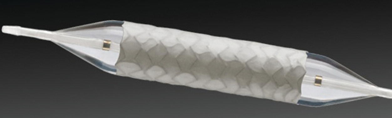 Total Endovascular Repair Of Thoracoabdominal Aortic