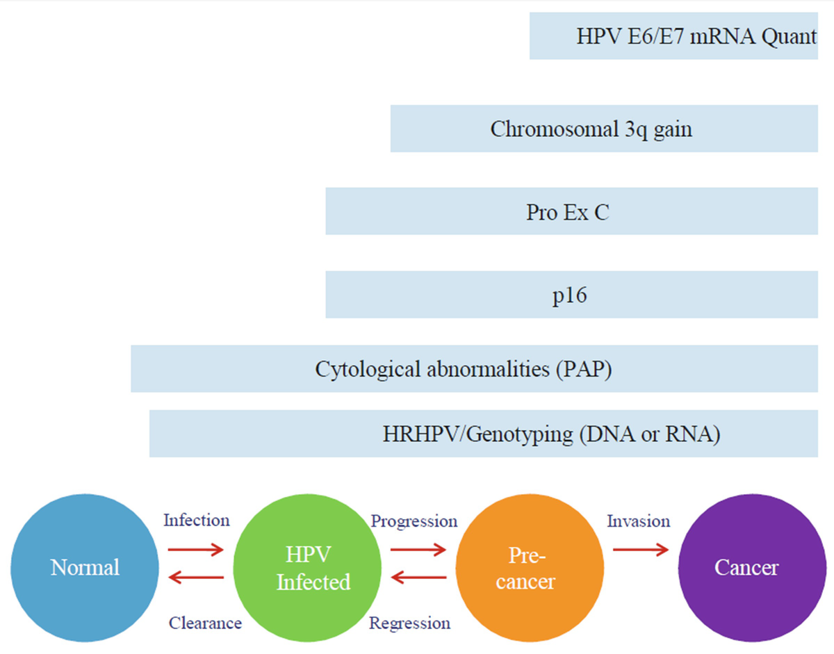 hpv screen high risk by tma cancer ovarian feminin