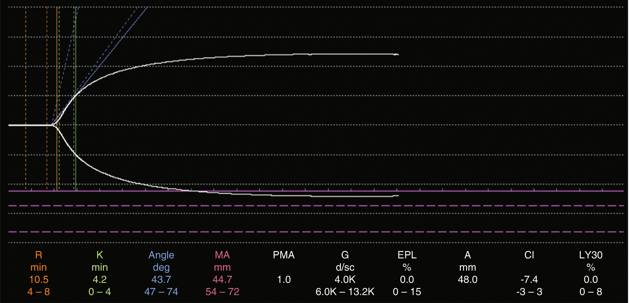 Ill Preoperative ... the Critically Trauma Acute Assessment of