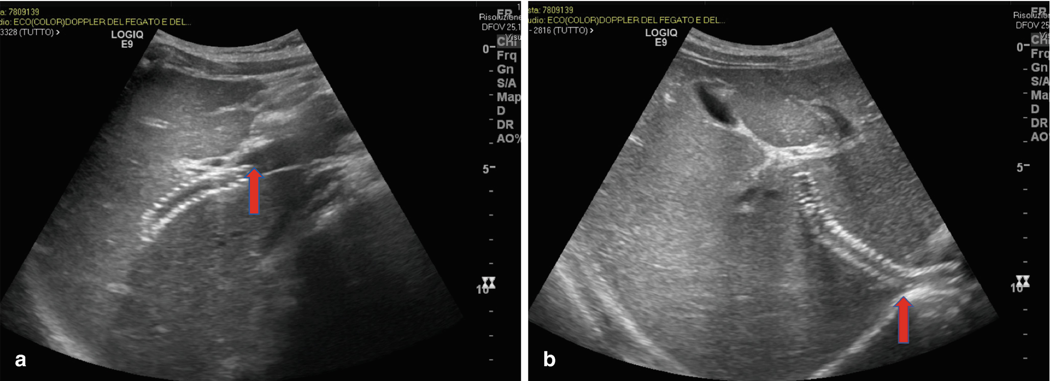 Diagnostic And Interventional Radiology Springerlink