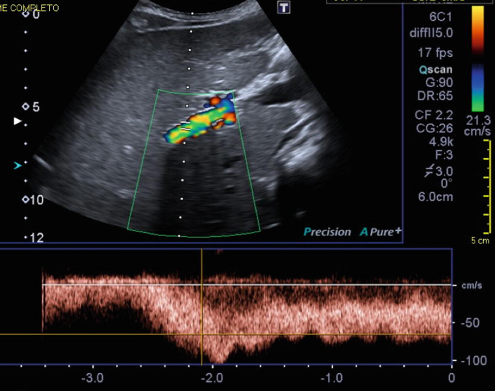 Diagnostic And Interventional Radiology Springerlink