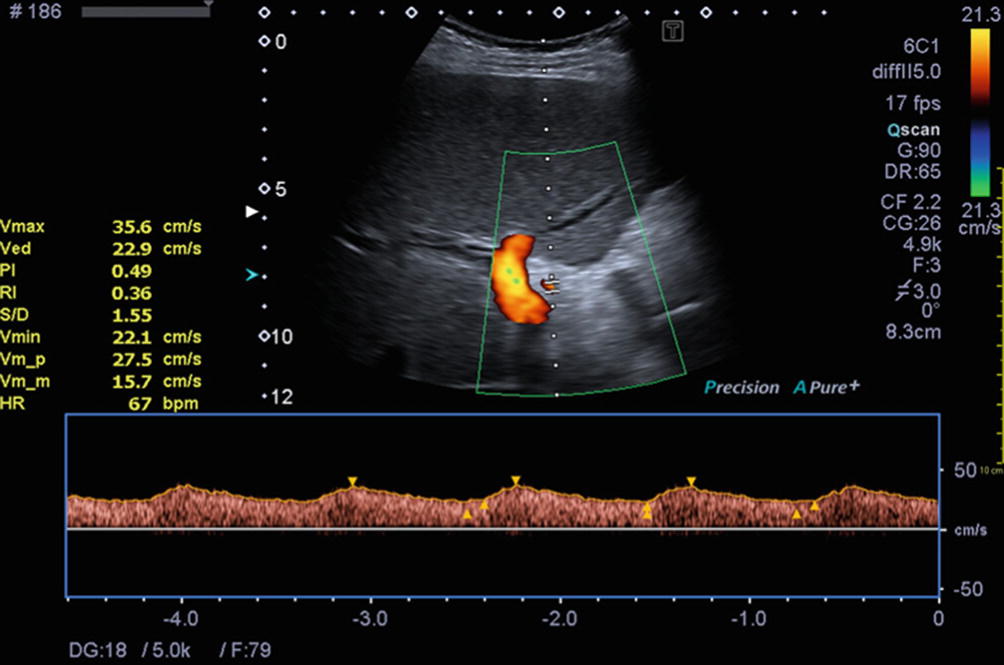 Diagnostic And Interventional Radiology Springerlink