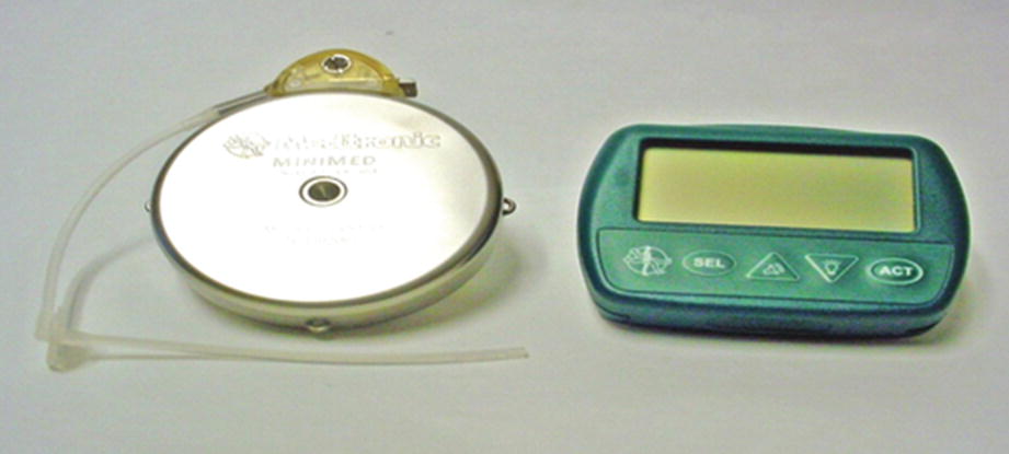 The Implantable Insulin Pump Springerlink The Implantable Insulin Pump Springerlink