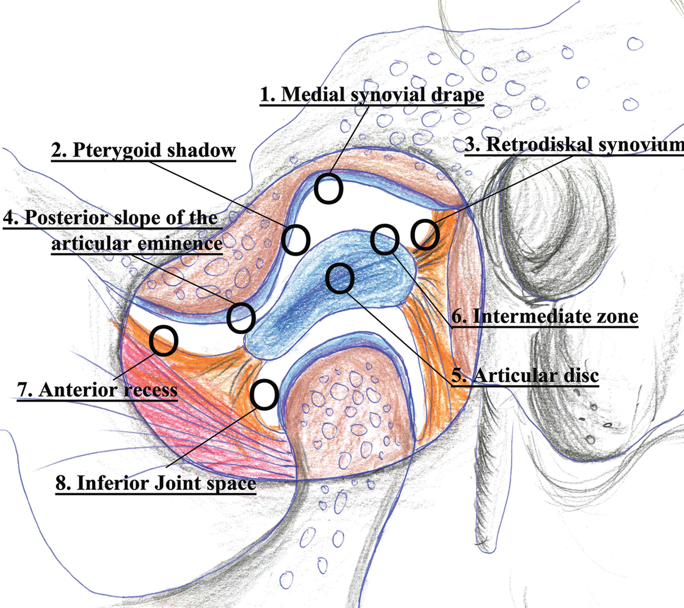 Surgery Of The Temporomandibular Joint Surgical Arthroscopy Springerlink<script async src=