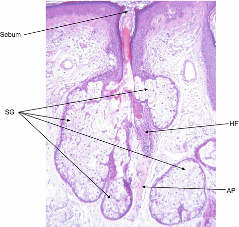 Anatomy Of The Sebaceous Gland Springerlink