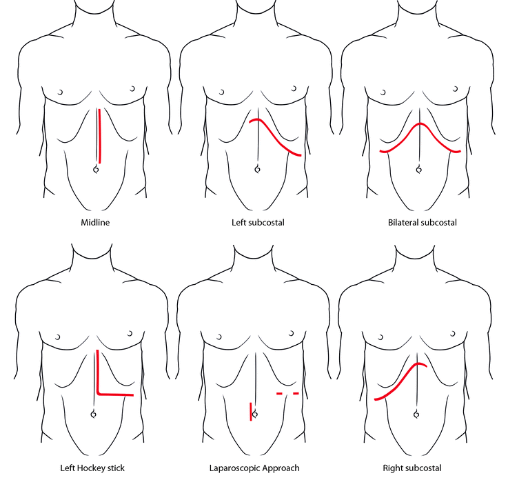 Pancreas And Duodenum Springerlink