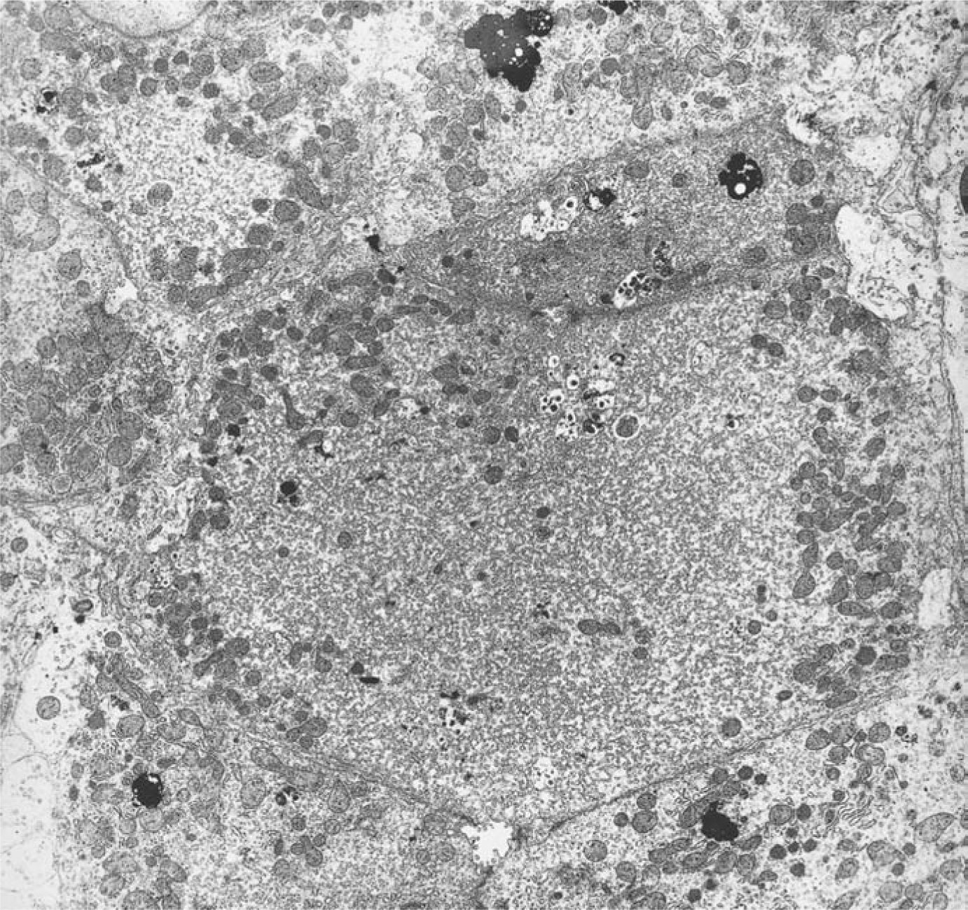 Cellular Adaptation Intracellular Inclusions And Deposits Springerlink