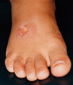 Child Abuse And Neglect Springerlink