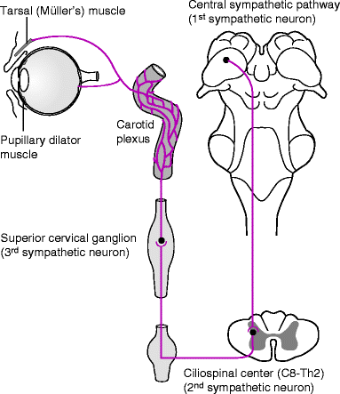 Anwendung dilator