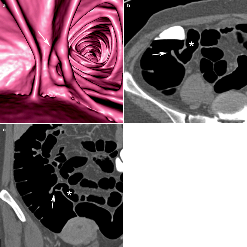 Normal Colon Springerlink - 