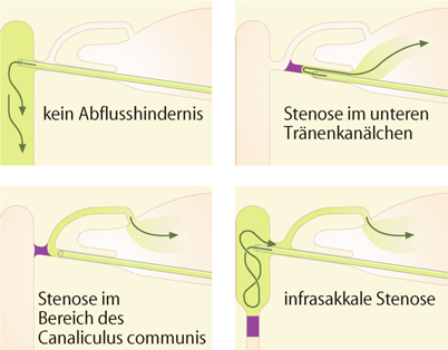 Kontrastmittel geschmack