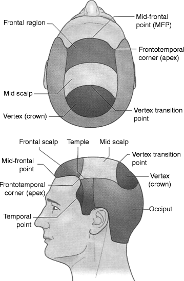 Hair Transplantation Springerlink