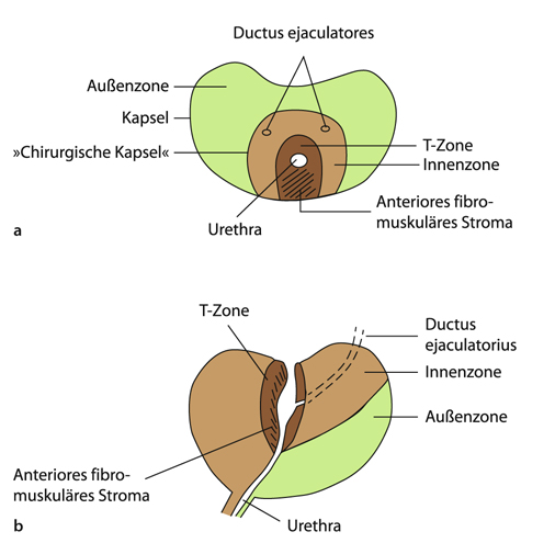 prostata zonen