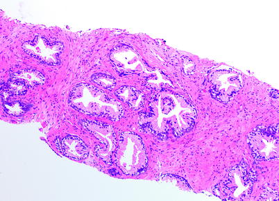 prostata histologia normal)