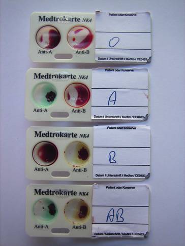 Blutersatz und Transfusionsmedizin | SpringerLink