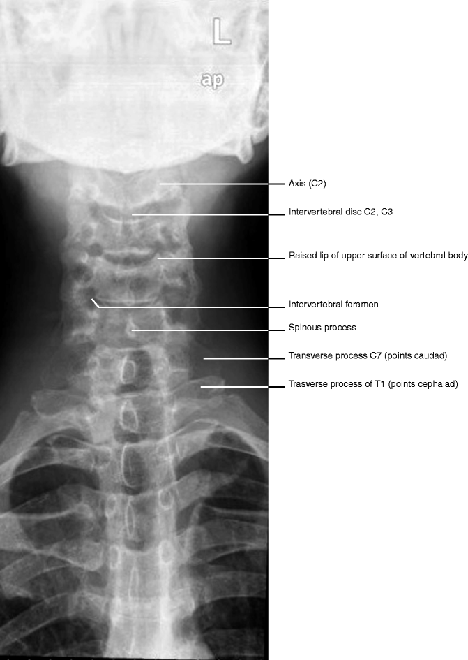 Vertebral Column | SpringerLink