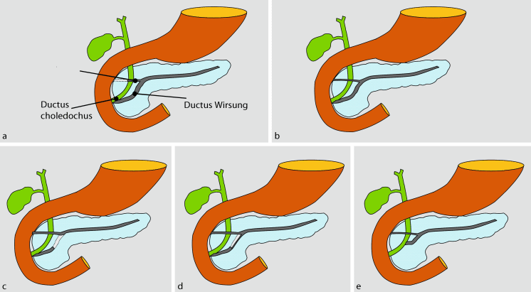 Physiologie Und Embryologie Des Pankreas Springerlink