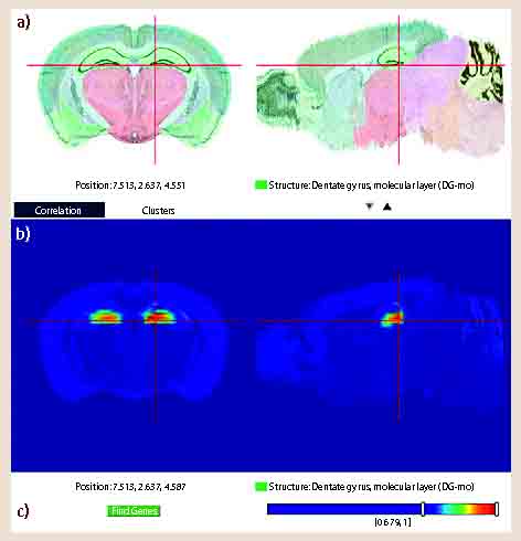 The Allen Brain Atlas | SpringerLink