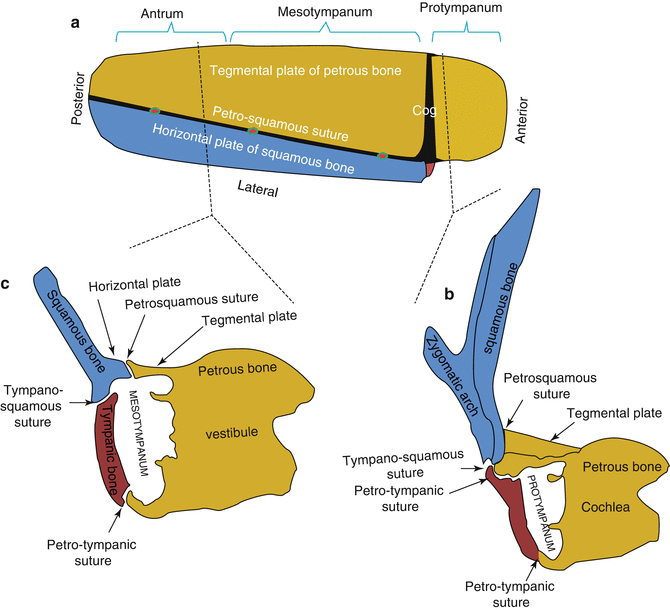 Middle Ear Cavity | SpringerLink