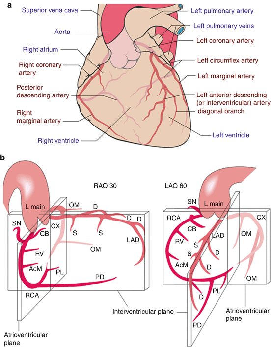 Diagnostic Coronary Angiography Springerlink