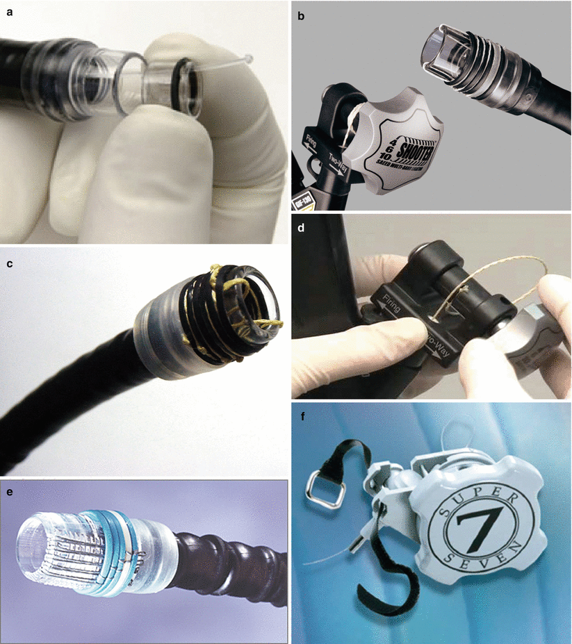 Endoscopic Treatment of Esophageal Varices SpringerLink