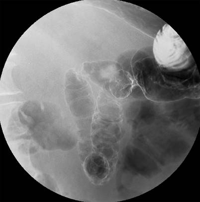 Gastrointestinal System Springerlink