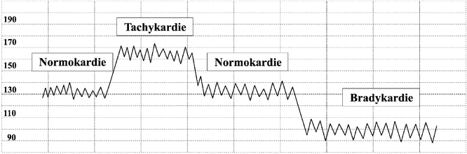 Ctg Werte Wehen Kardiotokografie 2020 01 20