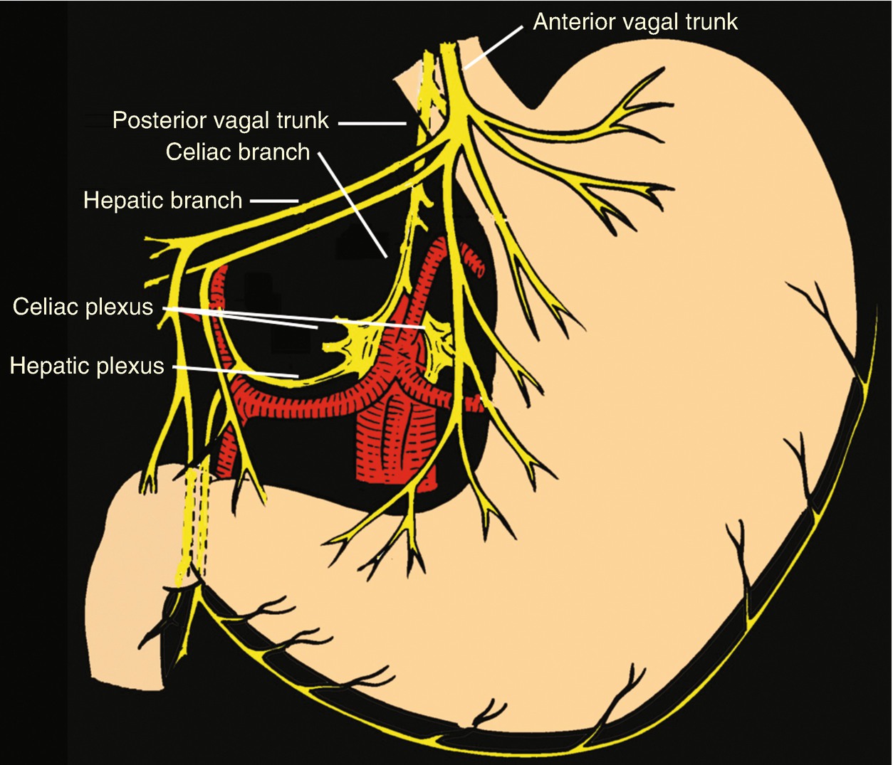 Gastric cancer vagotomy - Gastric cancer vagus nerve
