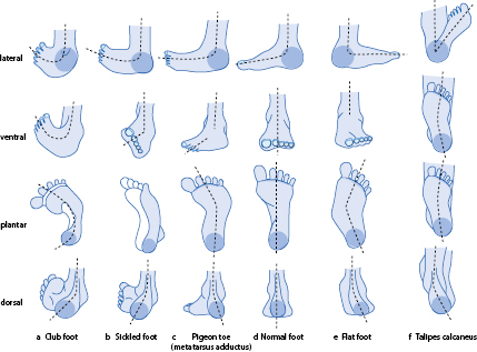 Retiform Pattern Foot Applications for Specific Indications | SpringerLink