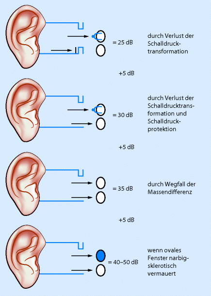 Ohr und Hören | SpringerLink