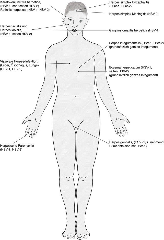 Humane Herpesviren Springerlink