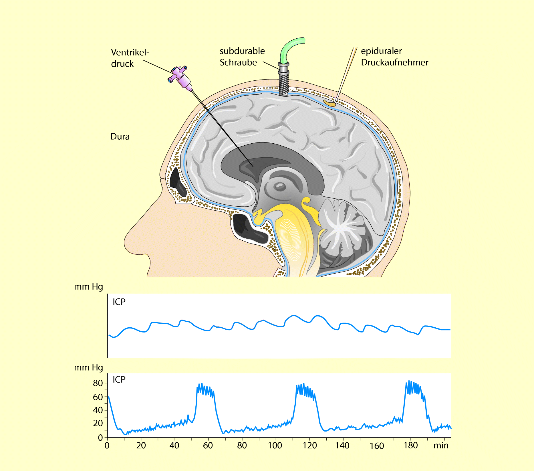 Neurointensivmedizin Springerlink