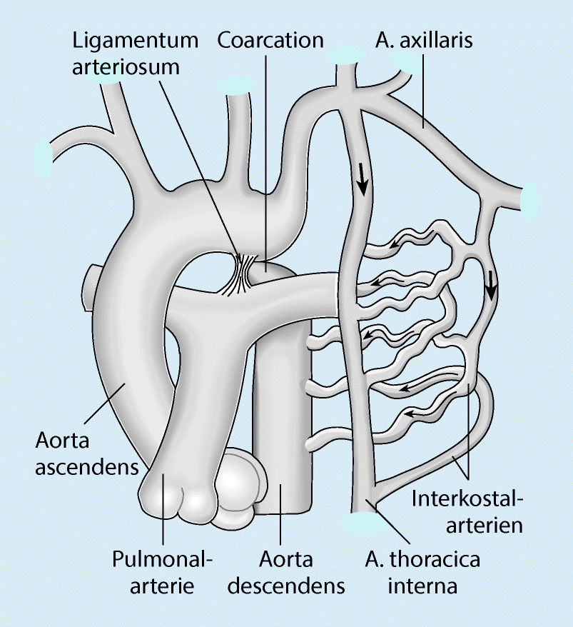Kongenitale Herzfehler Springerlink