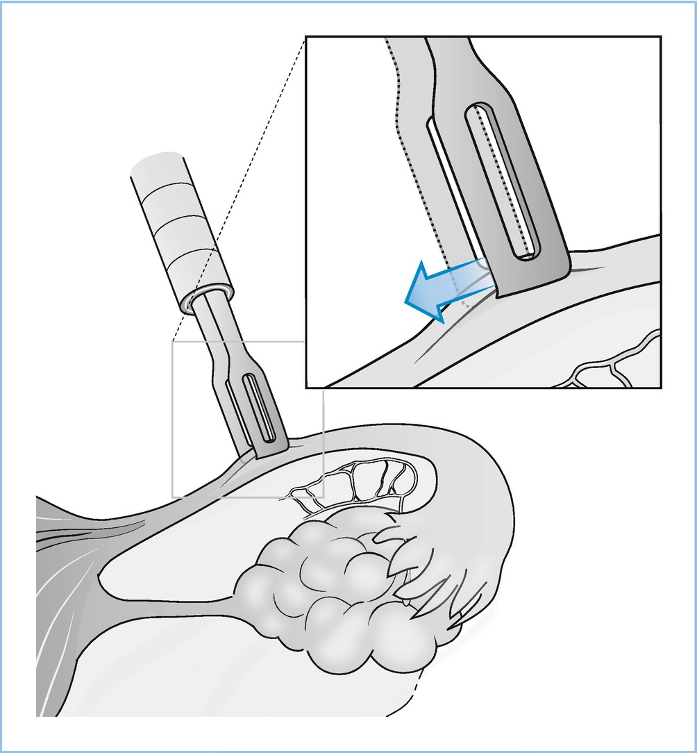 Sterilisation Springerlink