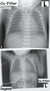 Padiatrie Springerlink