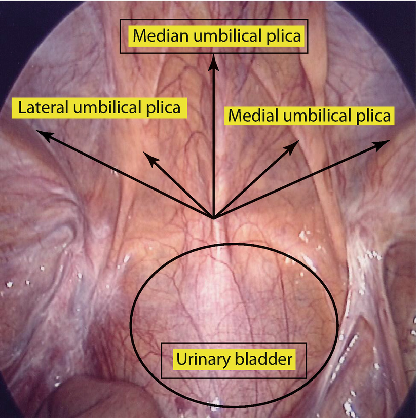 Clinical Anatomy of the Groin: Posterior Laparoscopic ...