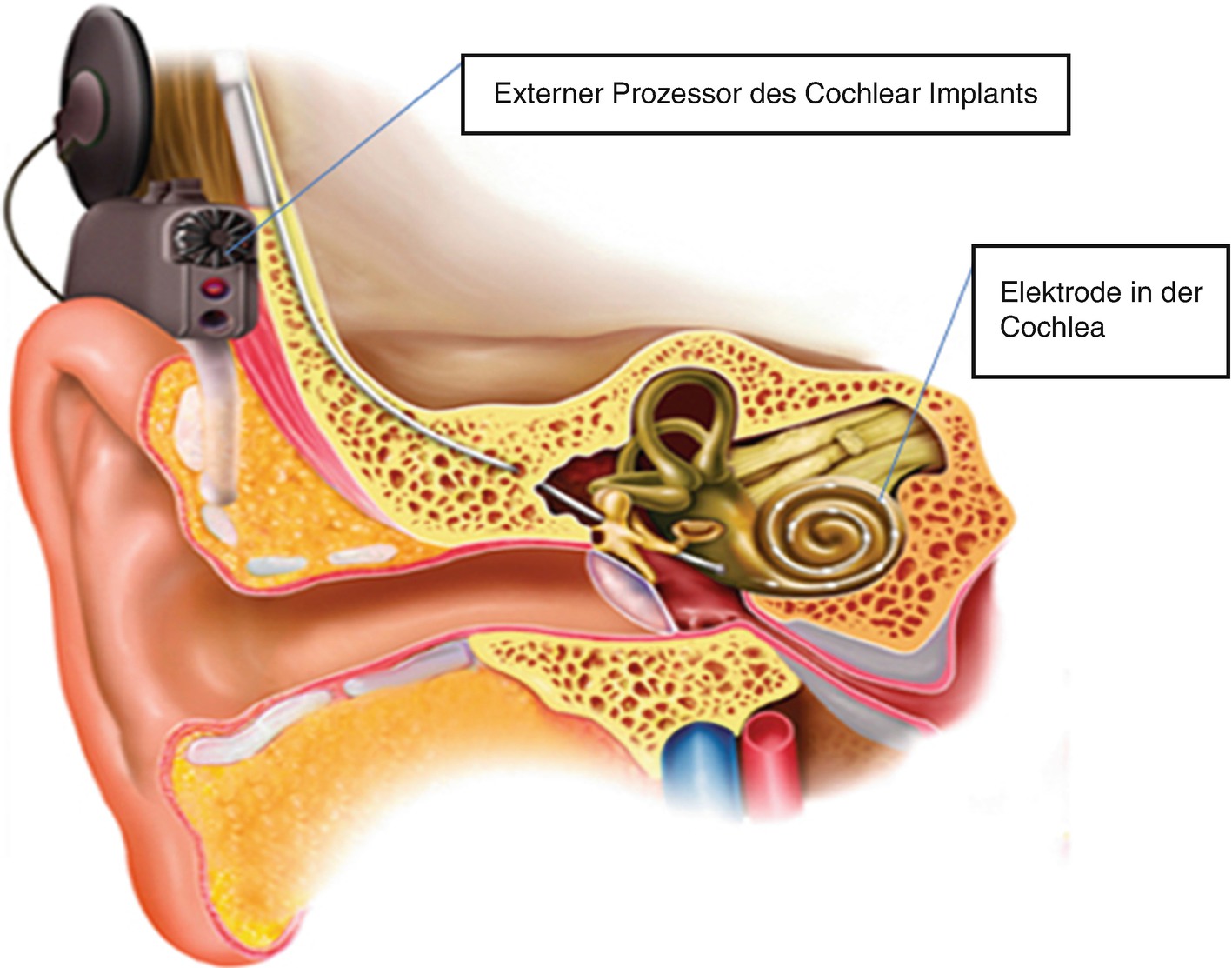 Knoten hinter der brustwarze mann