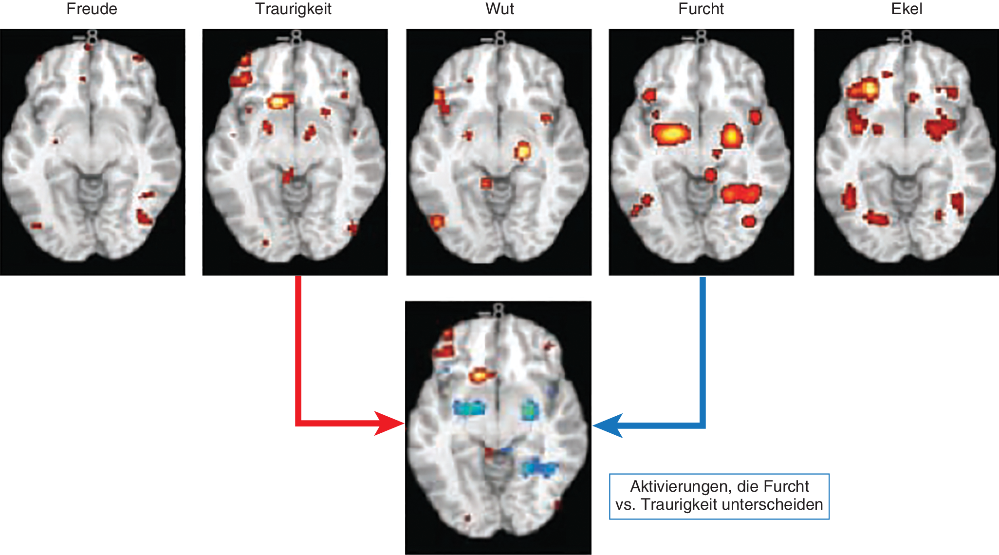 Neuronale Mechanismen Der Emotion Springerlink