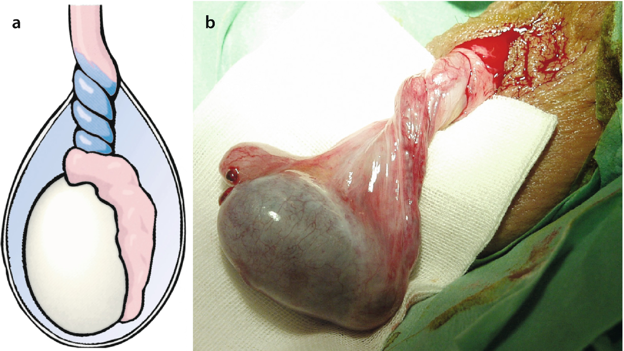 Oder penis blut fleisch ▷ Blutpenis