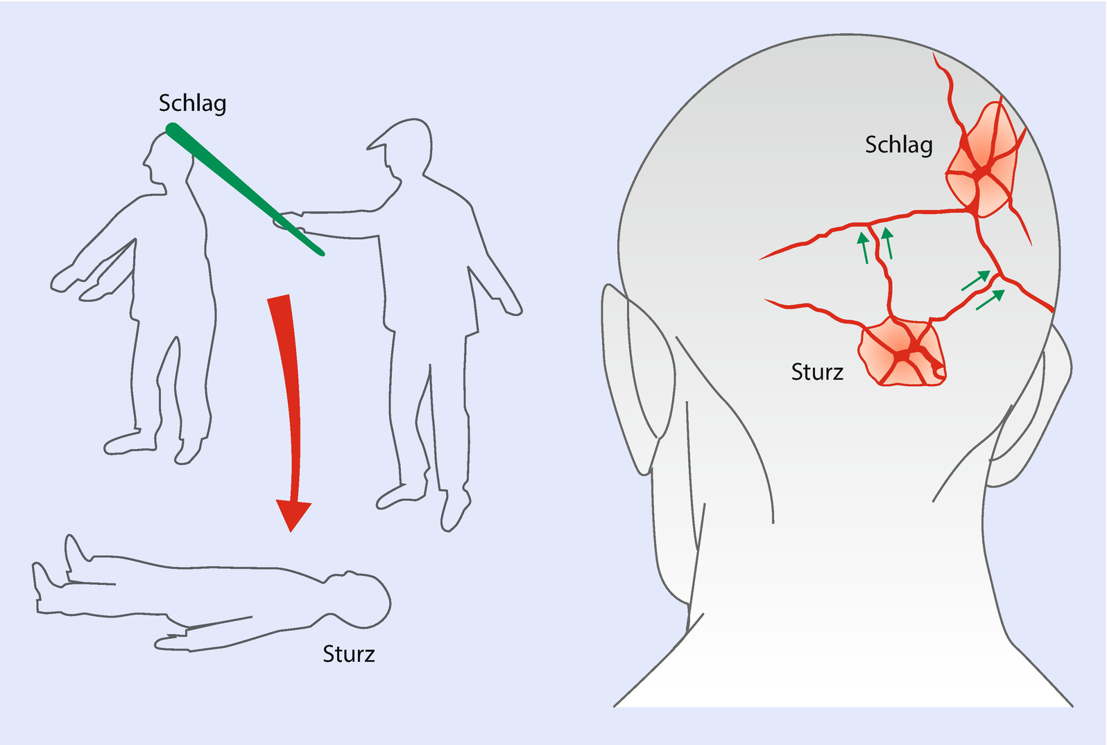 Forensische Traumatologie Springerlink