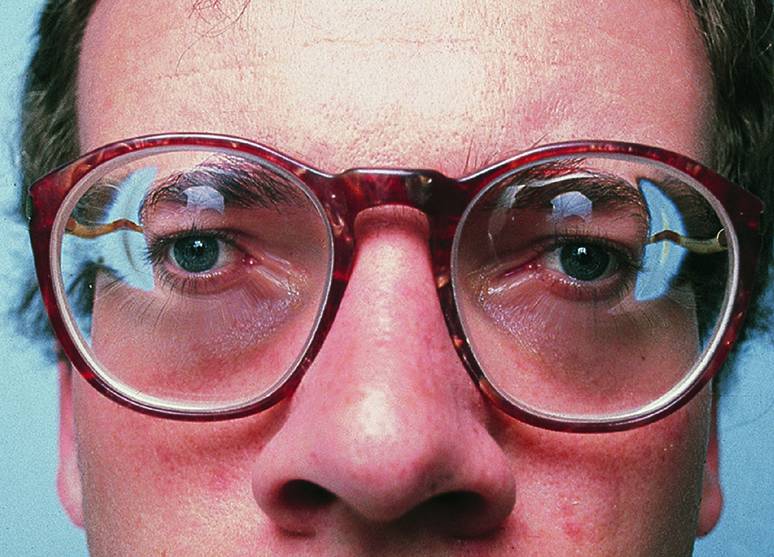 Refraktionsfehler: Brillen, Kontaktlinsen und refraktive Chirurgie |  SpringerLink