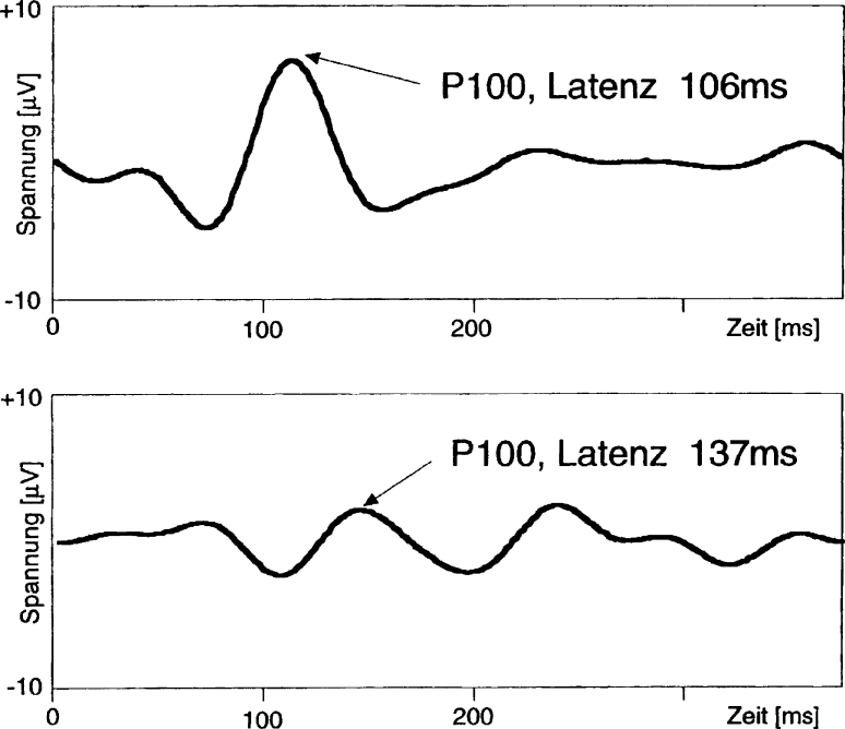 Untersuchungsmethoden Des Ophthalmologen Springerlink
