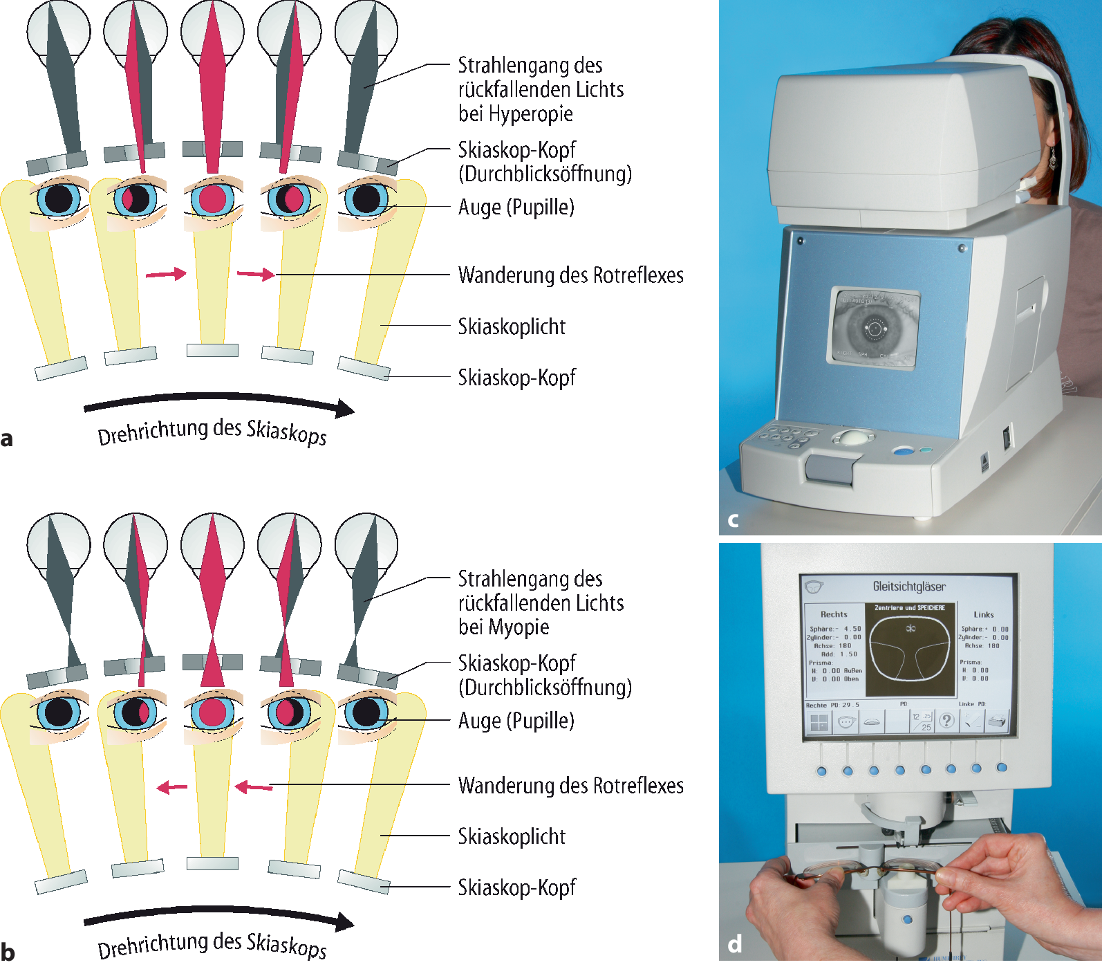 Untersuchungsmethoden Des Ophthalmologen Springerlink