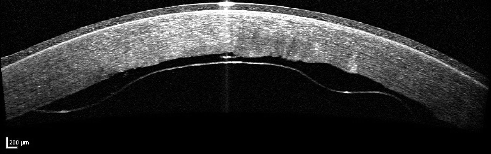 Untersuchungsmethoden Des Ophthalmologen Springerlink
