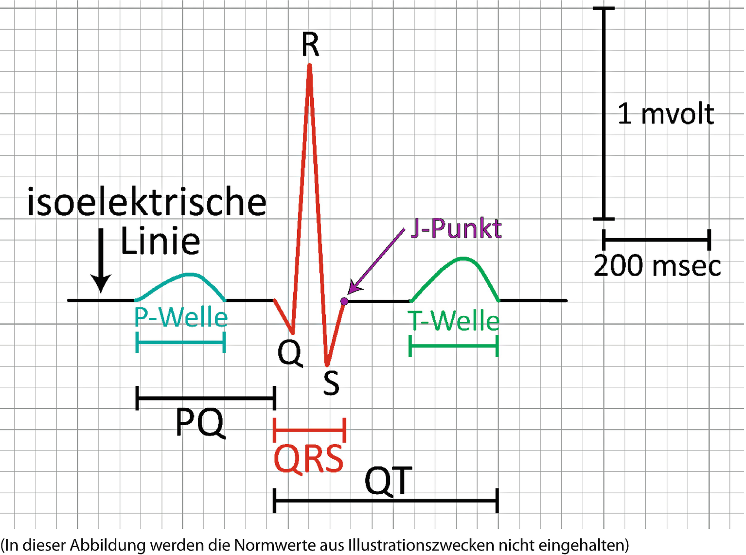 Bestandteile Der Ekg Kurve Springerlink