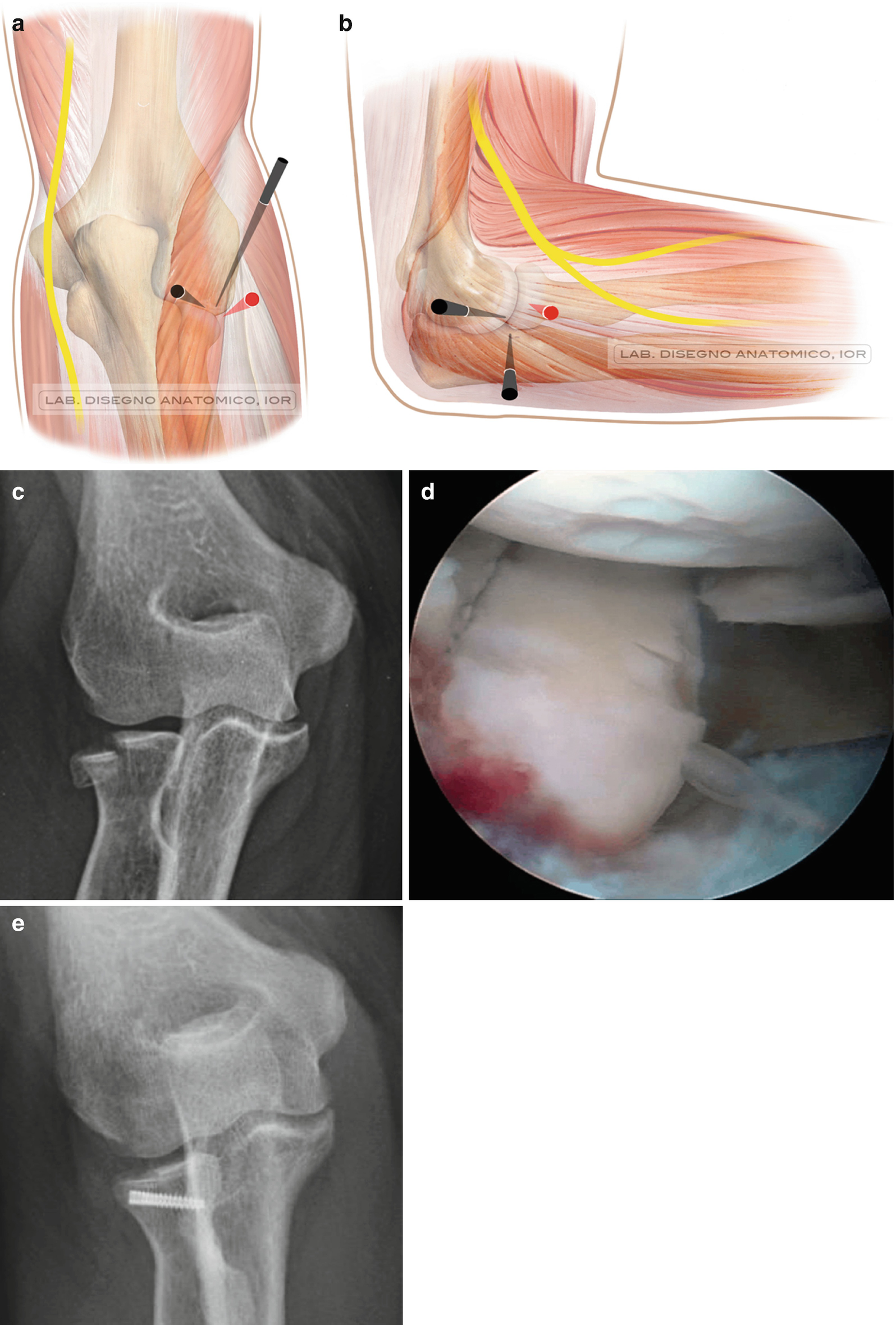 If You Have Osteoarthritis You Need Massage Massage Magazine Knee Osteoarthritis Osteoarthritis Knee Arthritis