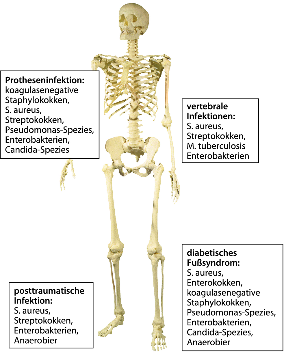 Infektionen der Knochen und Gelenke | SpringerLink