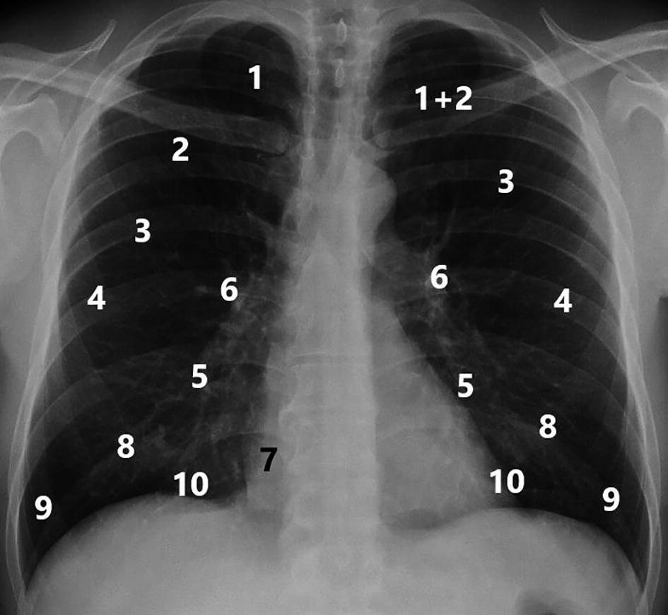 Rontgendiagnostik Springerlink