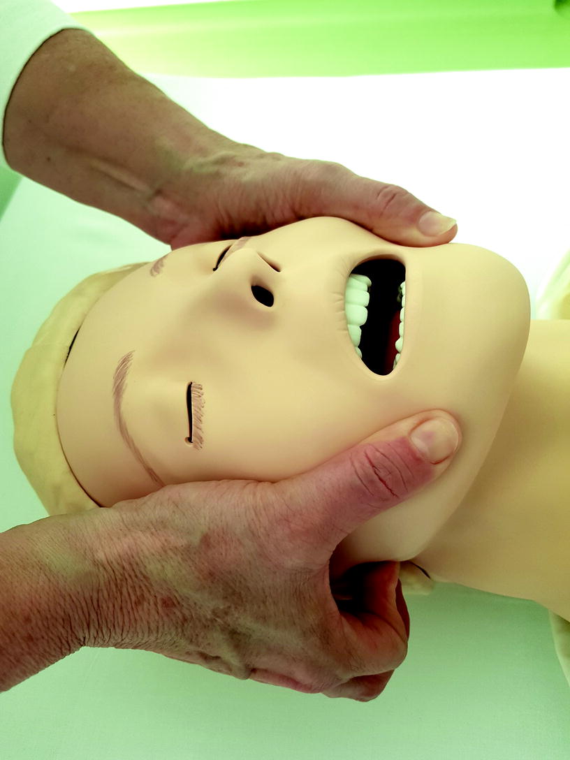 Atemwegsmanagement Und Intubation Springerlink